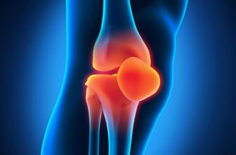 Артроз: Причины, Симптомы и Эффективные Методы Лечения заболеваний