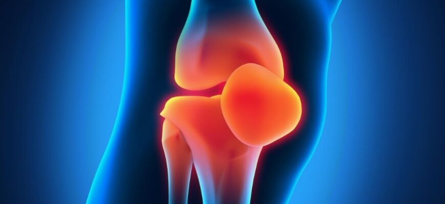 Артроз: Причины, Симптомы и Эффективные Методы Лечения заболеваний