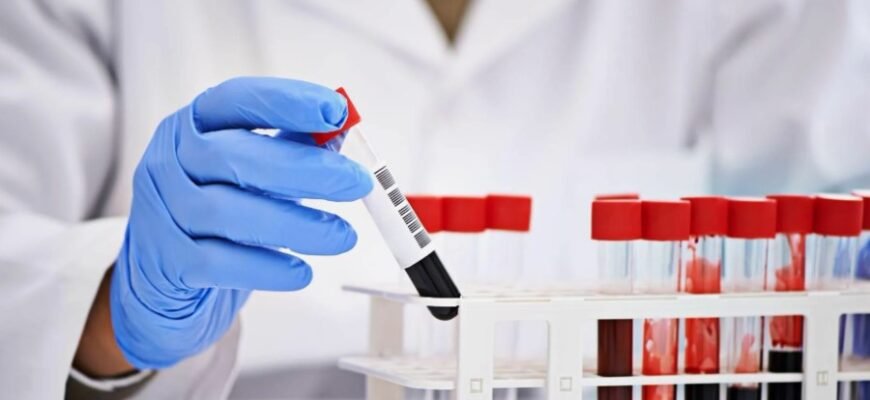 : Индекс HOMA: Определение, значение и его роль в оценке здоровья