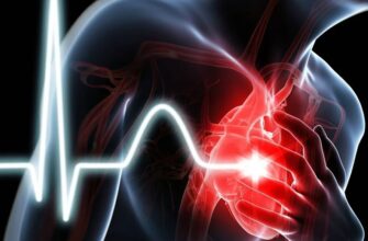 Что такое инфаркт: причины, симптомы и методы профилактики