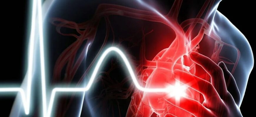 Что такое инфаркт: причины, симптомы и методы профилактики
