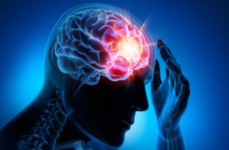 Что такое инсульт: причины, симптомы и методы лечения заболевания