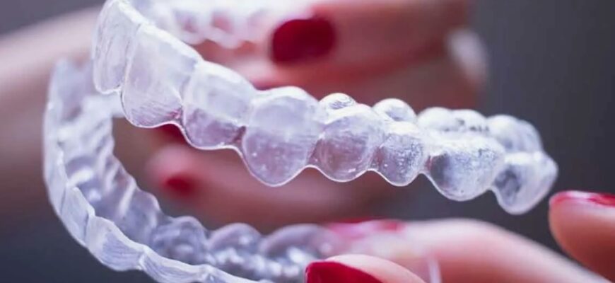 Что такое капа на зубы: виды, назначение и преимущества использования