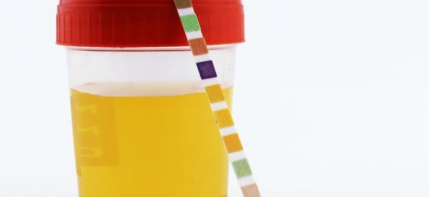 Олигурия: Основные причины, симптомы и методы лечения состояния