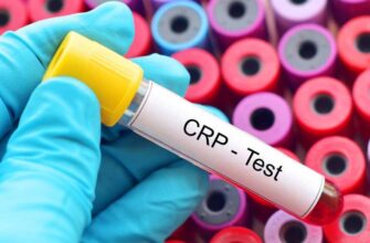 Что такое реактивный белок: значение, функции и диагностика