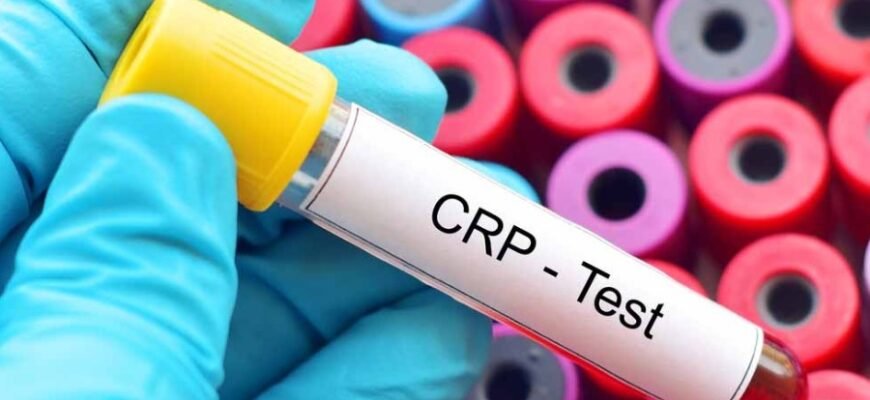 Что такое реактивный белок: значение, функции и диагностика