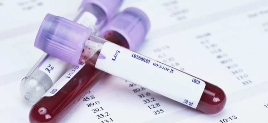 Что такое СОЭ в крови: значение нормы и причины отклонений
