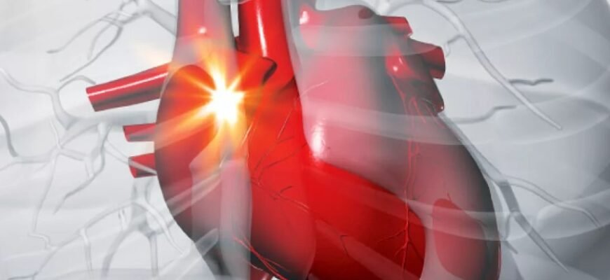 Что такое стенокардия: причины, симптомы и методы лечения