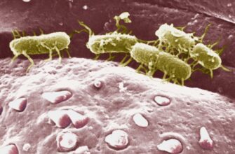 Что такое тиф: симптомы, причины и методы профилактики болезни