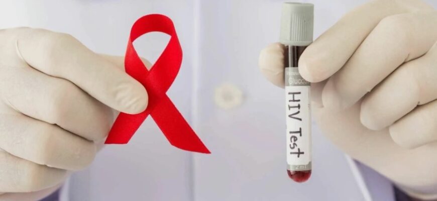 Всё, что нужно знать о ВИЧ: Причины, симптомы и лечение инфекции