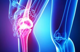 МРТ коленного сустава в «Нейромед»: когда нужно обследование, как оно проводится МРТ коленного сустава в «Нейромед»: когда нужно обследование, как оно проводится