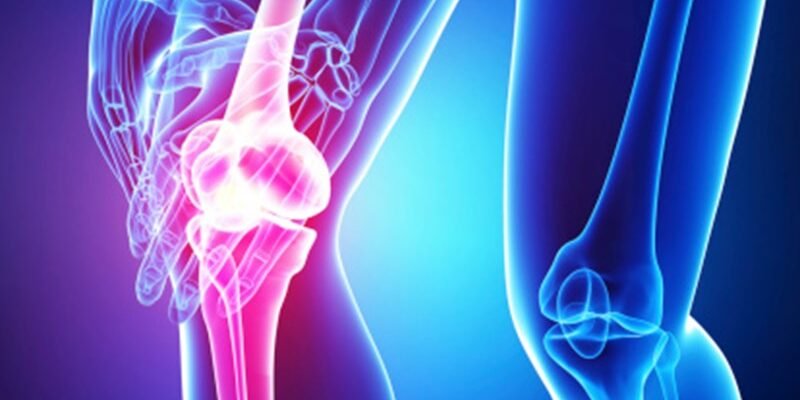 МРТ коленного сустава в «Нейромед»: когда нужно обследование, как оно проводится