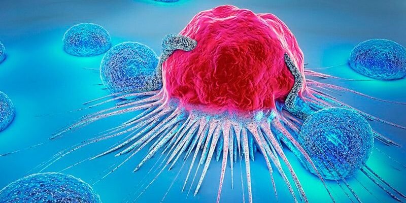 Онкология – симптомы и диагностика рака